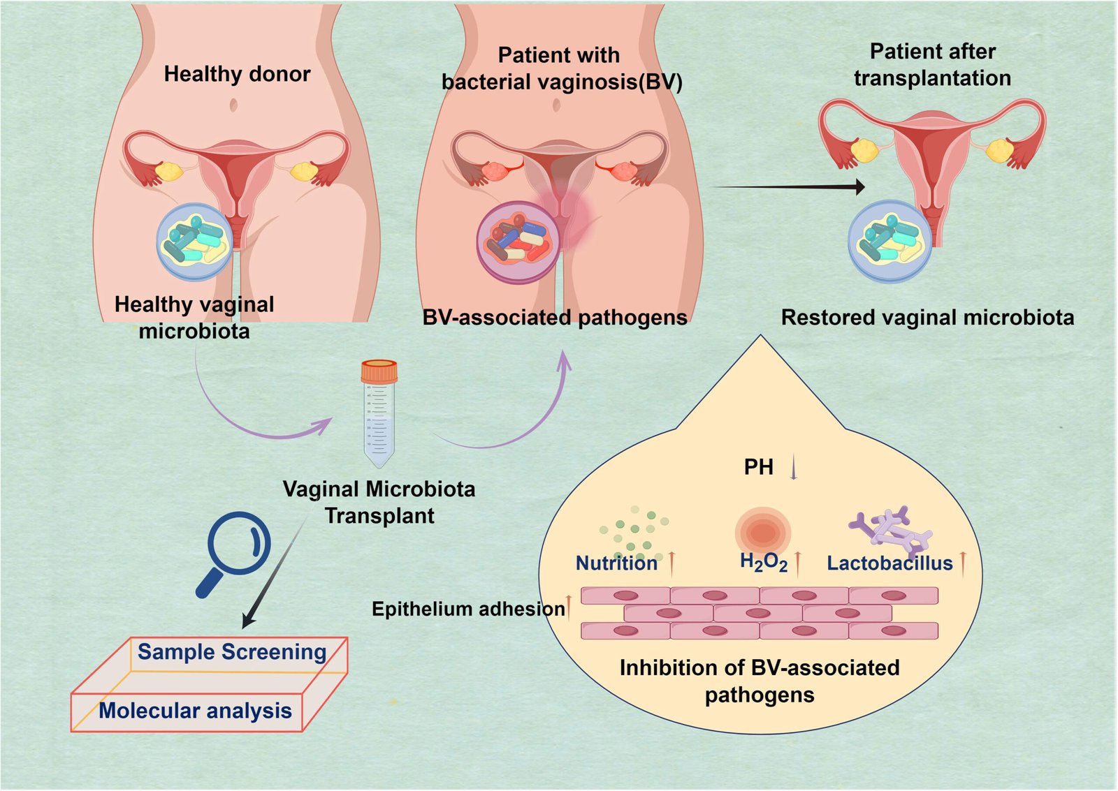 Signs Your Vaginal Flora